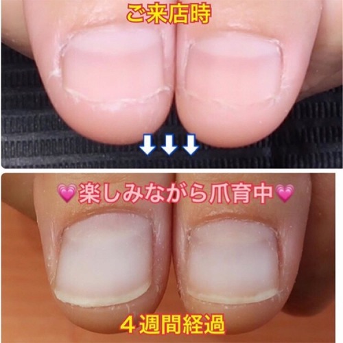 U Nail ユーネイル 魅せたくなる手に育てるサロン ハンドケア ジェルネイルサロン